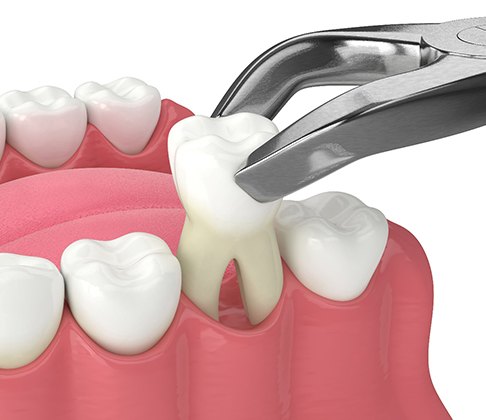 Dentist showing removed tooth to patient