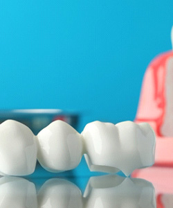 Dental bridge in front of sample implant on reflective surface with light blue background