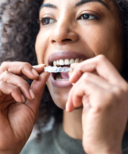Woman placing Invisalign over upper arch