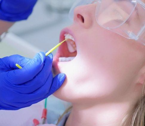 Dental patient receiving fluoride treatment