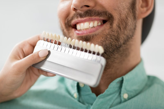 Dentist comparing veneers to a patient’s natural teeth.